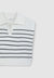 Striped waistcoat